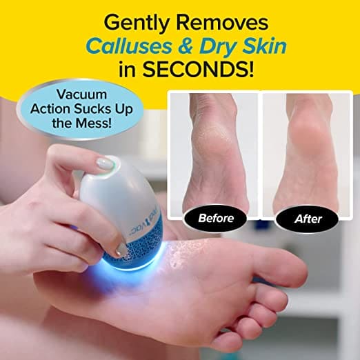 Pedi Vac Callus Remover